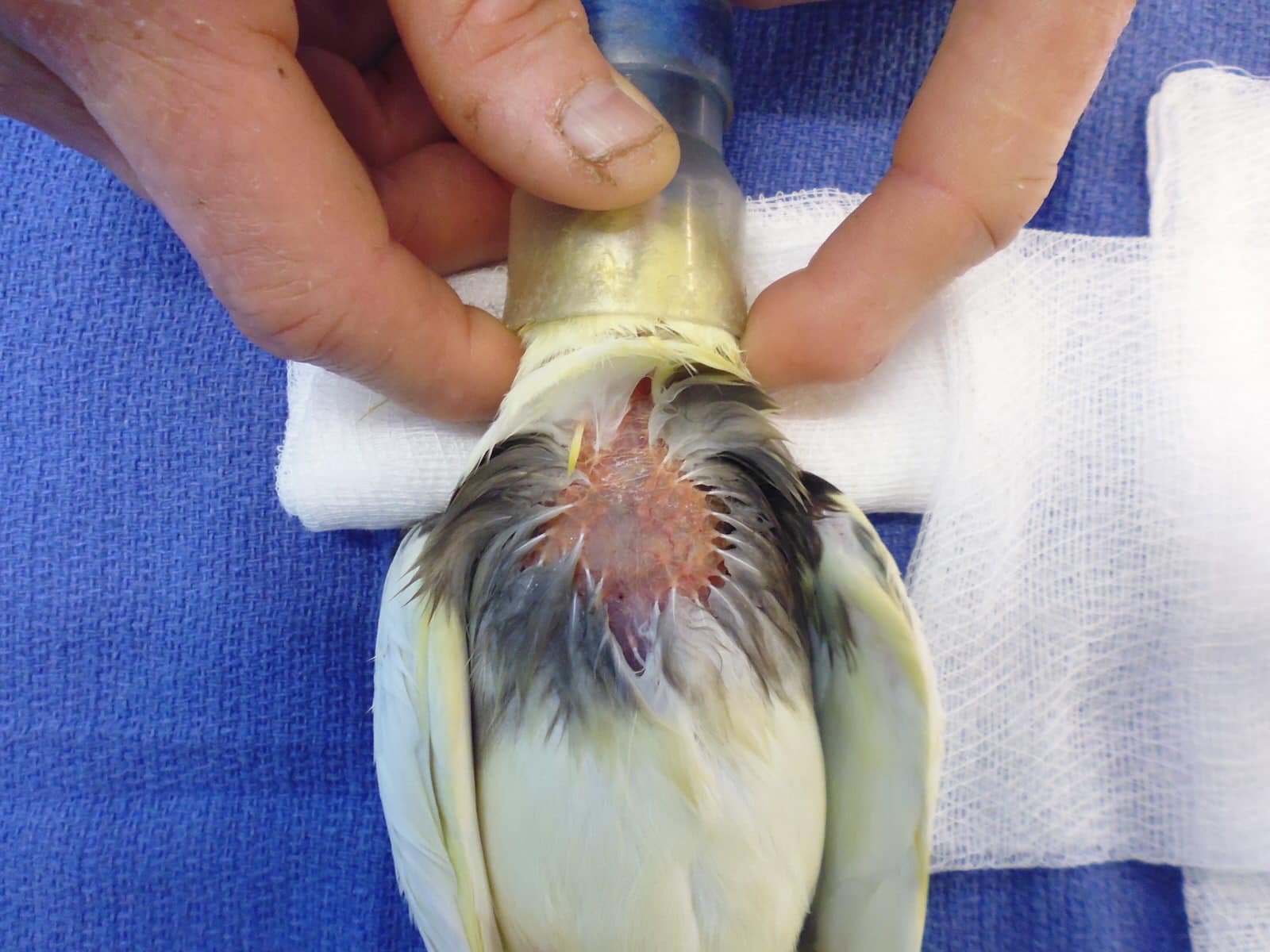 PDF Parrot Beak Nail Case Report and Review of Parrot Beak Nail Dystrophy   Semantic Scholar
