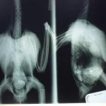 Metal Toxicity X-Ray